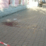 Миллион взыскивают в пользу барнаульца, на которого рухнула штукатурка - ИА Амител