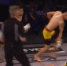 Боец MMA получил "одну из самых отвратительных" травм руки - ИА Амител