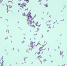 Listeria monocytogenes Culture - ФГБУ ЦНПВРЛ