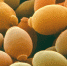 Saccharomyces cerevisiae под микроскопом / Фото: Yandex - ИА Амител
