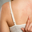 Каков ваш уровень SPF? - Министерство здравоохранения