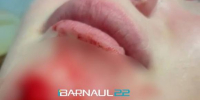 Мальчишка розочкой от бутылки порезал лицо девочке в Барнауле - Barneos22.ru