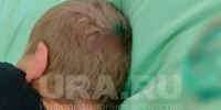 Пациентов держали в ужасных условиях / Фото: URA.ru - ИА Амител